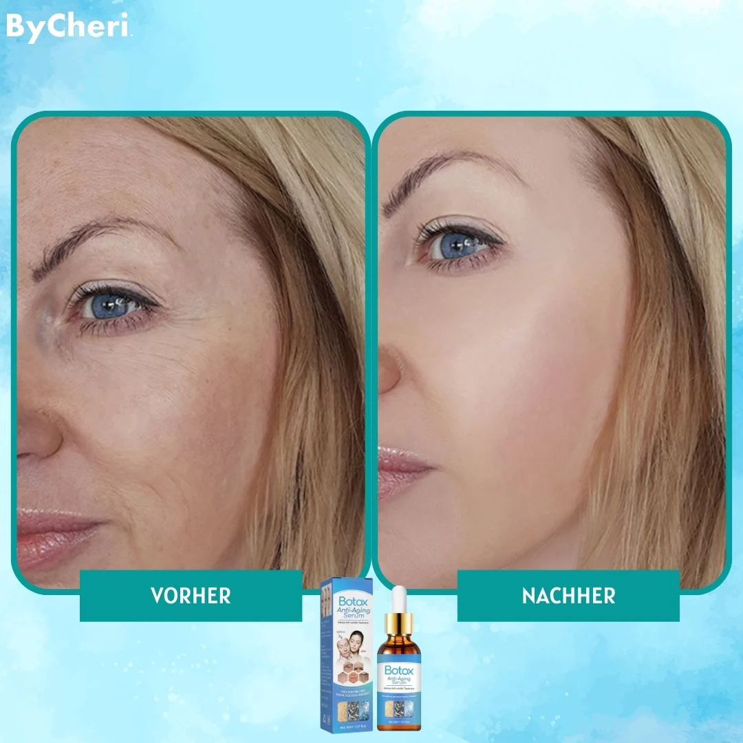 1+1 FREE | YouthGlow™ Botox Anti-Aging Serum - Image 3