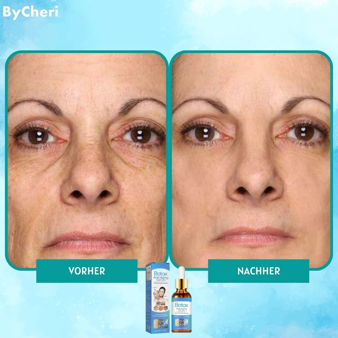 1+1 FREE | YouthGlow™ Botox Anti-Aging Serum - Image 4